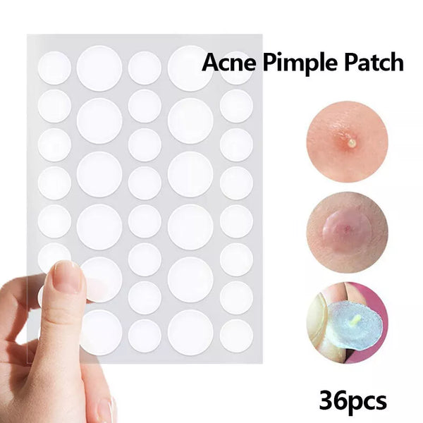 36 Count, Hydrocolloid Acne Patches, Invisible Waterproof Pimple Spot Stickers Shell Star Creations