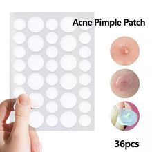 36 Count, Hydrocolloid Acne Patches, Invisible Waterproof Pimple Spot Stickers Shell Star Creations
