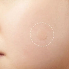 36 Count, Hydrocolloid Acne Patches, Invisible Waterproof Pimple Spot Stickers Shell Star Creations